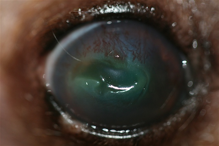ulcera-corneal-estromal