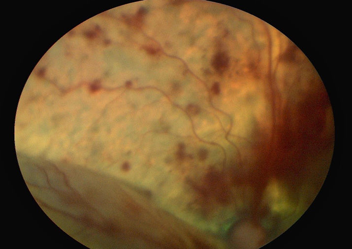 Desprendimiento retina gato con hipertensión arterial
