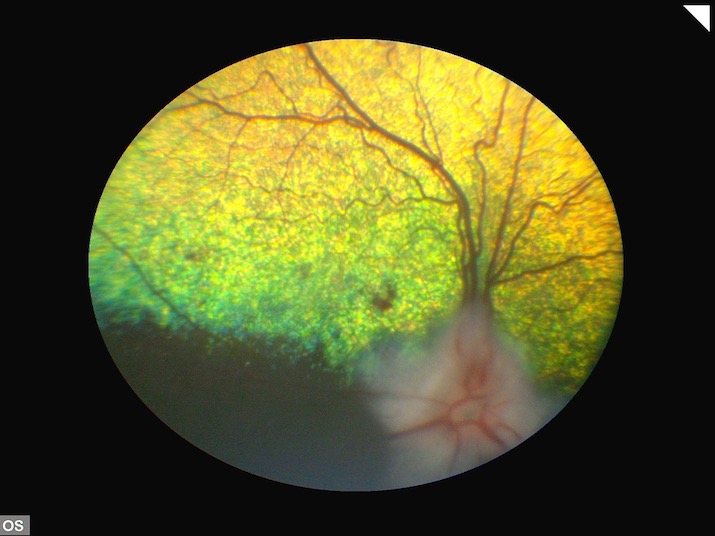 retinopatia-diabetica-beagle-13a