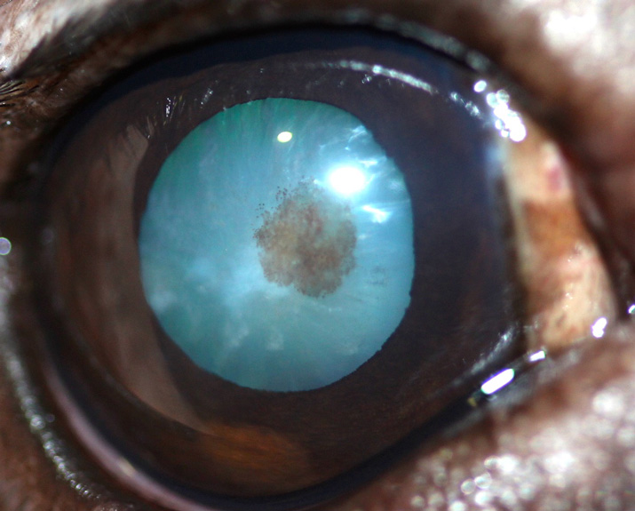 Membrana pupilar persistente