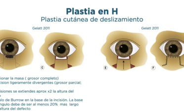 Curso 1 - Cirugia párpados - Programa cirugía oftalmológica veterinaria