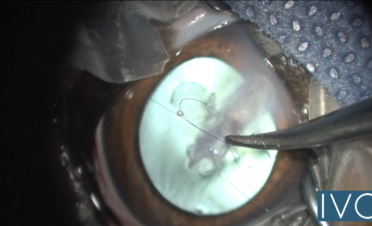 Prácticas del curso de microcirugía de la Córnea