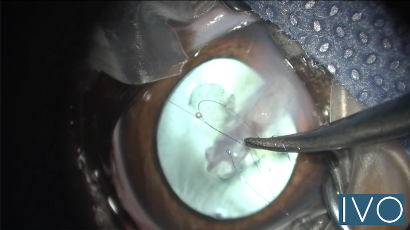 Prácticas del curso de microcirugía de la Córnea