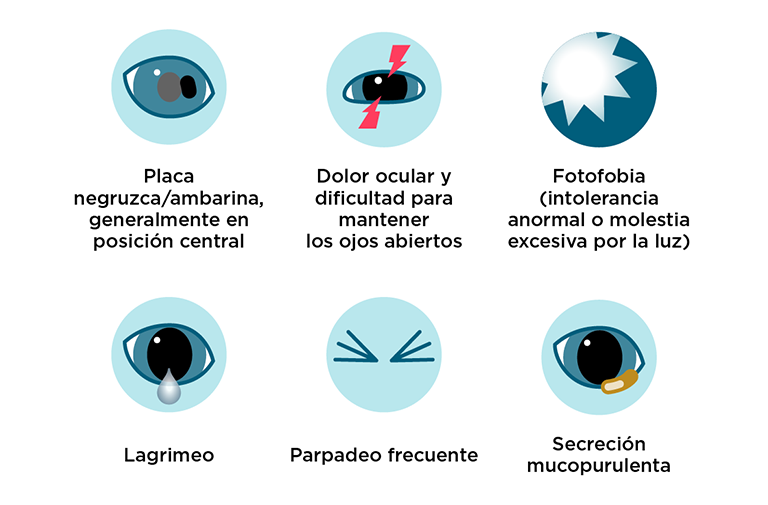 Síntomas de secuestro corneal