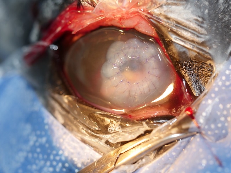Ojo de caballo tras una queratoplastia por úlcera corneal