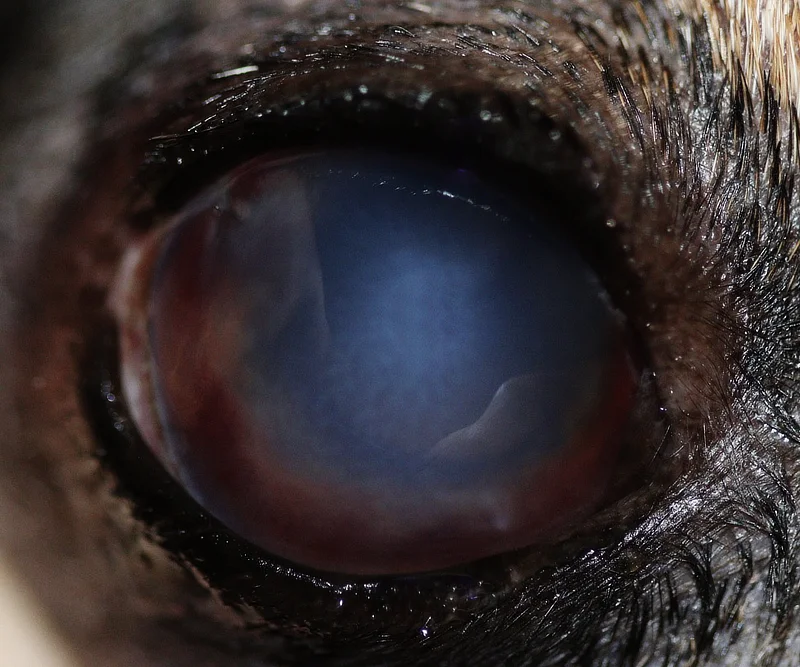 Primer plano del ojo de un perro mostrando una severa opacidad azul grisácea en la córnea, junto con áreas de hemorragia en la parte inferior del ojo. La condición ocular sugiere una luxación avanzada del cristalino, con posible daño severo a las estructuras oculares. La piel alrededor del ojo es visible, con el pelaje oscuro del perro en el fondo.