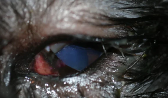 Primer plano del ojo izquierdo de Nala, mostrando inflamación severa y protrusión de la membrana nictitante. El ojo está enrojecido e hinchado, con opacidad visible, lo que sugiere una infección grave como un absceso retrobulbar. La imagen ilustra la gravedad de la condición antes del tratamiento.