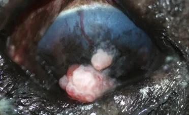 Primer plano del ojo derecho de un bulldog inglés con un carcinoma de células escamosas corneal, mostrando lesiones blanquecinas y rosadas sobre la córnea, con una superficie rugosa y vascularización aumentada.