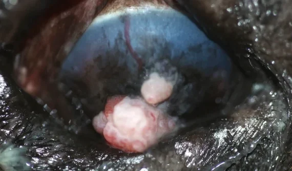 Primer plano del ojo derecho de un bulldog inglés con un carcinoma de células escamosas corneal, mostrando lesiones blanquecinas y rosadas sobre la córnea, con una superficie rugosa y vascularización aumentada.