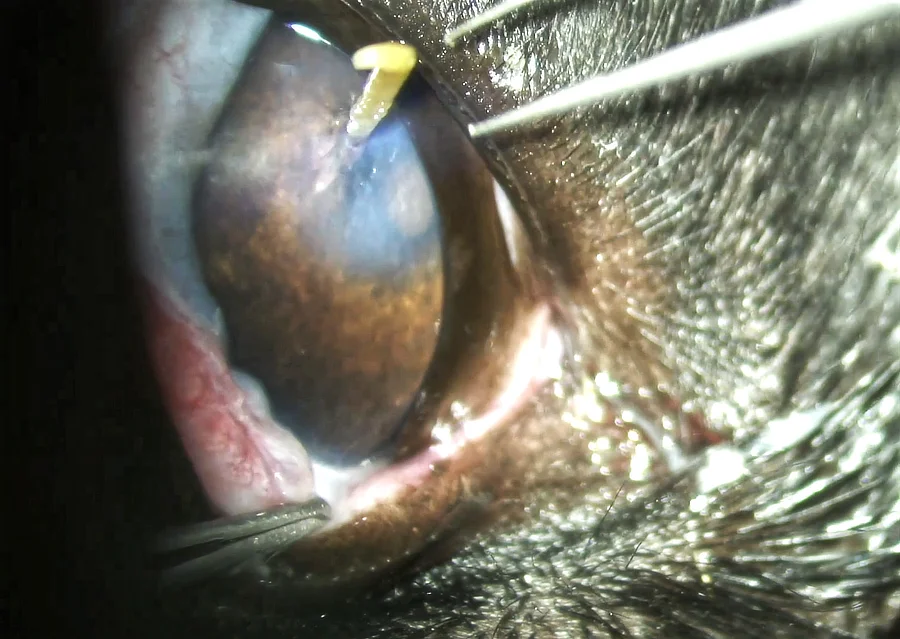 Primer plano del ojo de Duna mostrando el cuerpo extraño vegetal penetrando completamente la córnea, evidenciando la gravedad del cuerpo extraño y la necesidad de intervención quirúrgica.