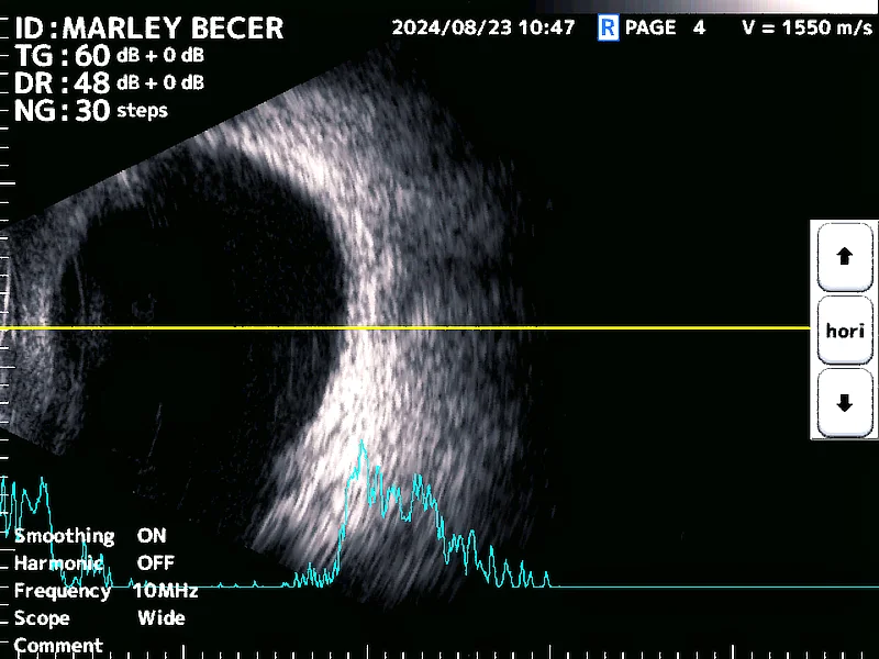 Ecografía ocular del ojo derecho de Marley, mostrando un corte transversal donde las estructuras oculares internas, como el cristalino y la cámara posterior, se observan normales y sin presencia de masas.