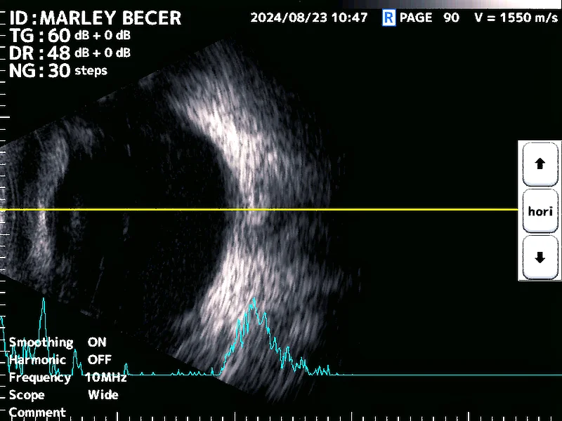 Segunda imagen ecográfica del ojo derecho de Marley, destacando la claridad de las estructuras intraoculares y confirmando la ausencia de lesiones o alteraciones orbitarias, compatible con un síndrome de Horner idiopático.