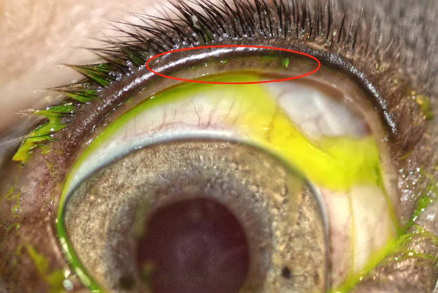 Detalle del ojo de un Bulldog Francés donde se observa una línea de pestañas anómalas en el borde del párpado superior, destacadas con fluoresceína.