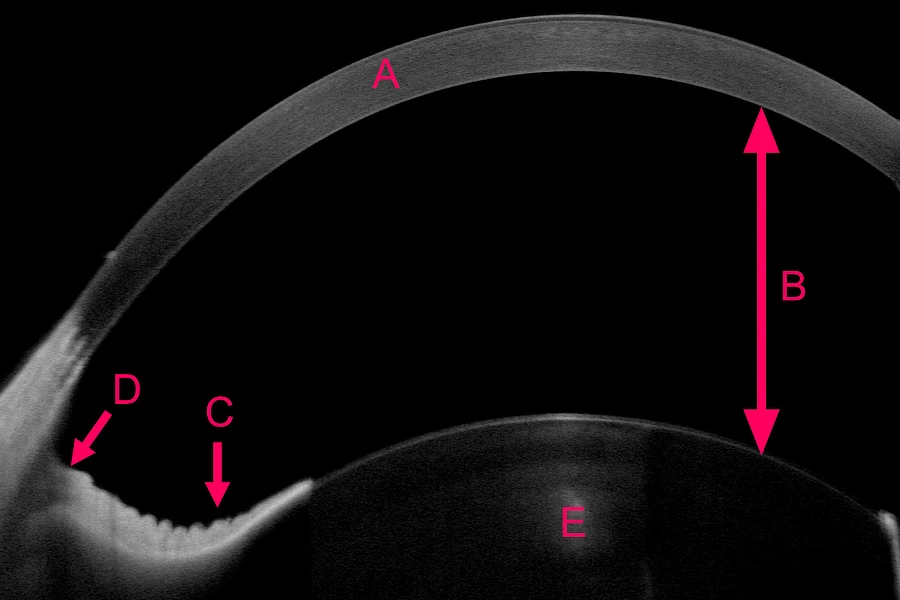 Corte transversal del ojo de un perro obtenido por Swept-Source OCT, con córnea, iris, cámara anterior y cristalino etiquetados.