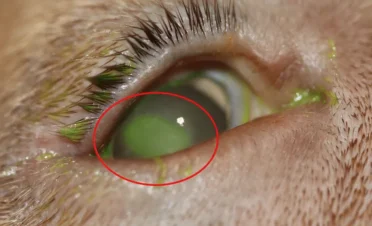 Primer plano del ojo de un perro con tinción de fluoresceína que revela una úlcera corneal causada por un cilio ectópico, resaltada con un círculo rojo.