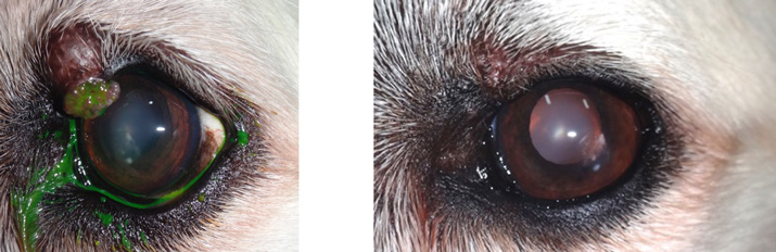 Cirugia tumor palpebral antes y despues