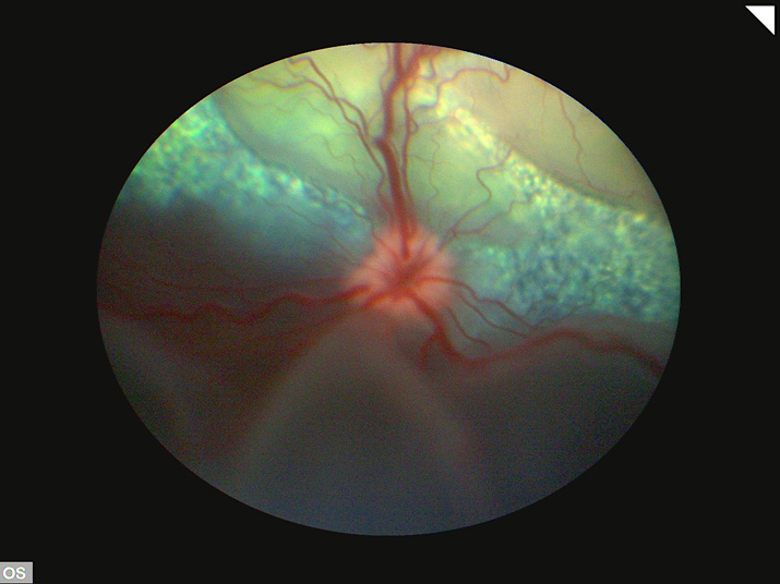 Desprendimiento de retina exudativo perro