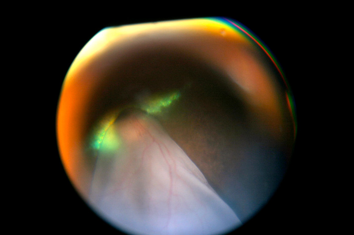 Desprendimiento retina regmatógeno en perro