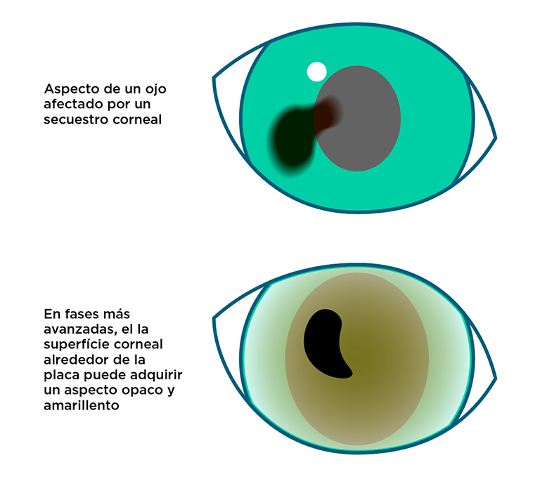 Síntomas de secuestro corneal