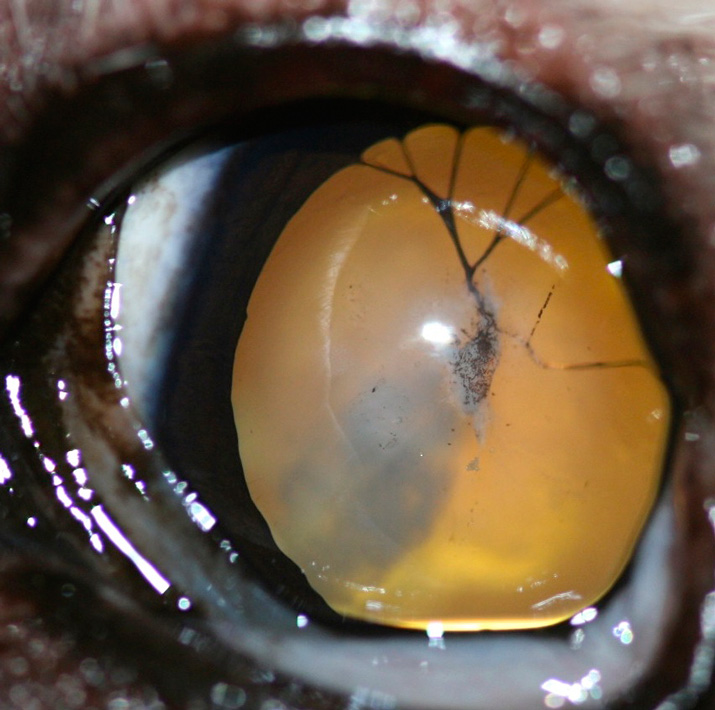 Membrana pupilar persistente