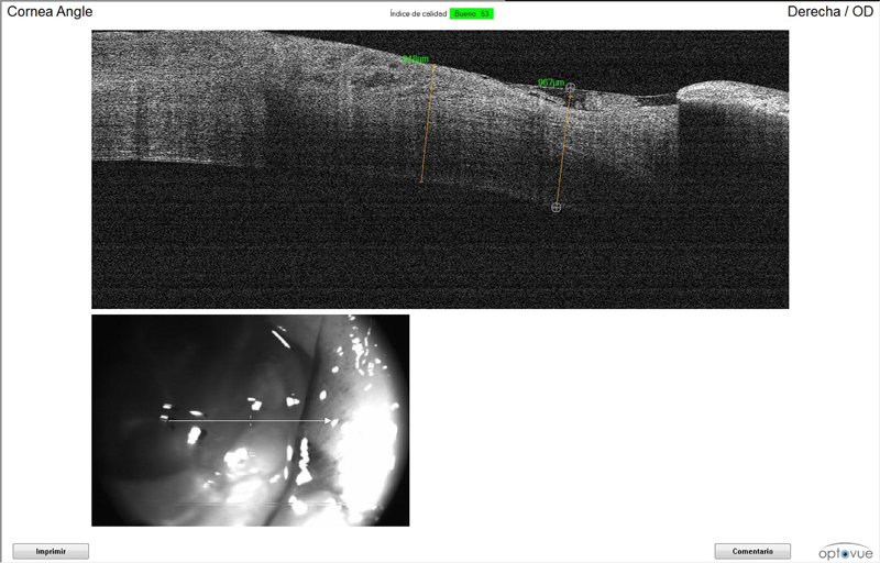 OCT perro con ulceración por procesionaria