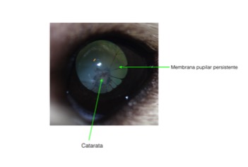 Ojo-Tommy-MPP-catarata