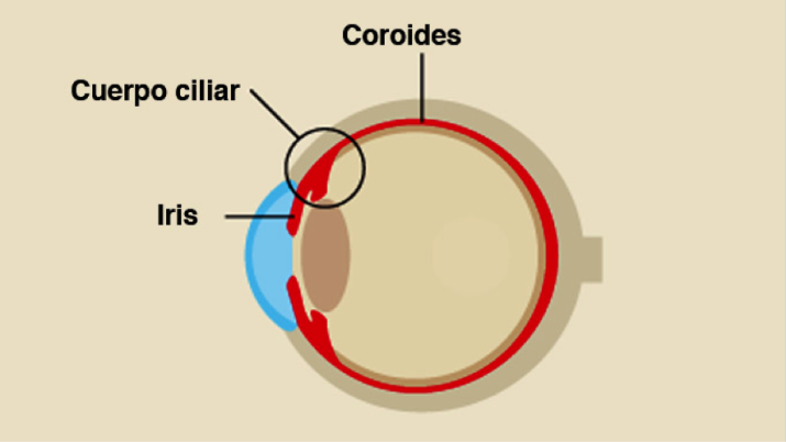 Origen melanoma ocular