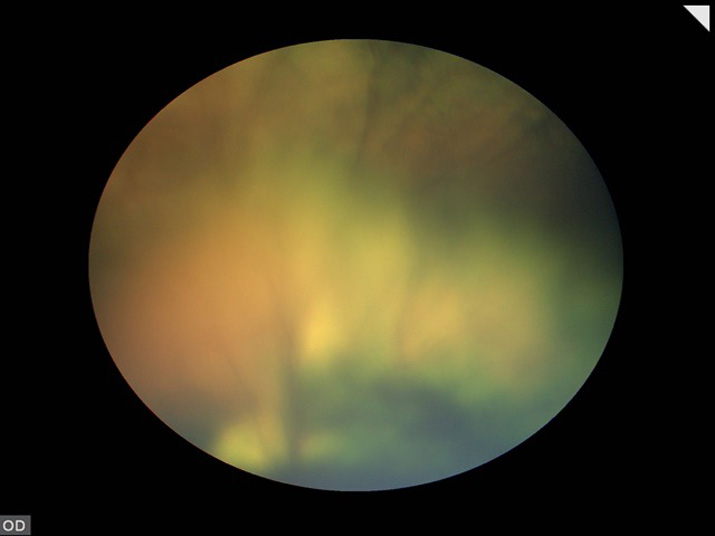 Retinografia caso glaucoma en perro