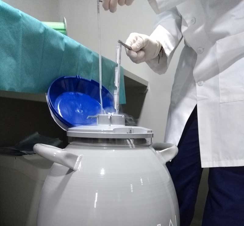 Conservación de células madre en laboratorio IVO