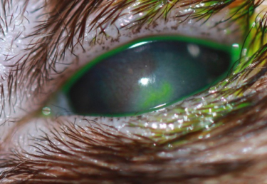 Ojo de hurón con queratitis fúngica