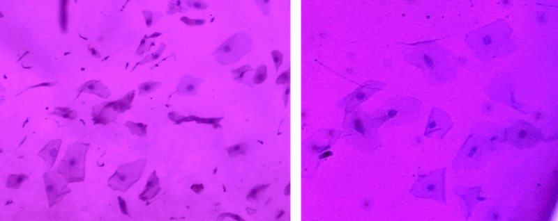 Citología de impresión conjuntival en caballo