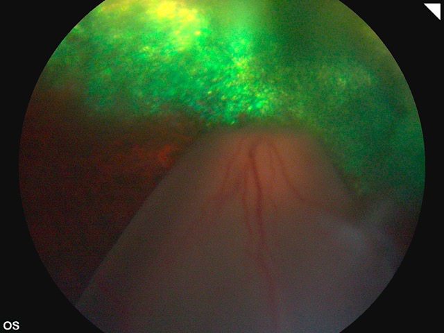 Desprendimiento de retina en perro - Caso Currito OS