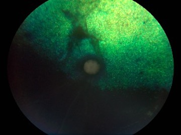 Desprendimiento de retina en gato a las 12 semanas de tratamiento