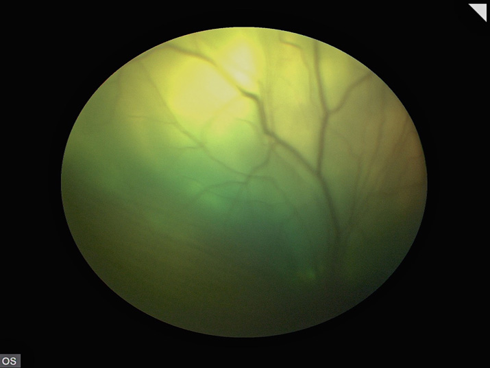 Desprendimiento retina perro diabético