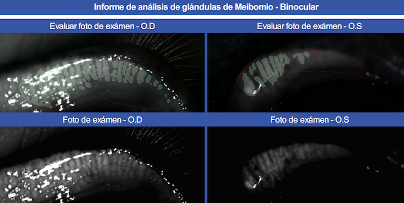 Meibografía infrarroja en un caballo