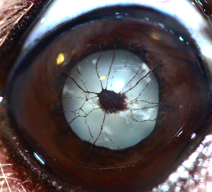 Membrana pupilar persistente