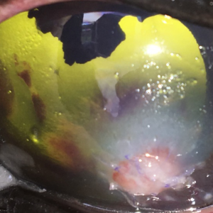 Ojo de caballo después de trasplante corneal