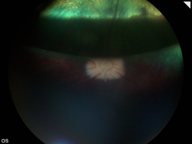 Retinografia postcirugía vitrectomía perro