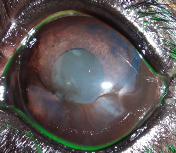 Ojo de perro después de tratamiento por queratitis superficial crónica o pannus