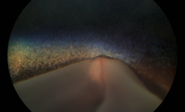 Retinografia perro con desprendimento de retina - Caso Fox