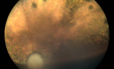 Retinografia perro post vitrectomia por desprendimento de retina - Caso Fox