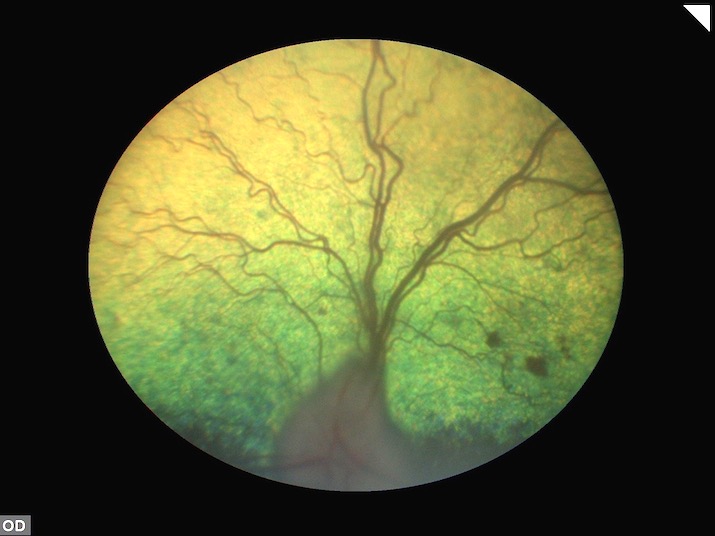 Retinopatía diabética en un perro